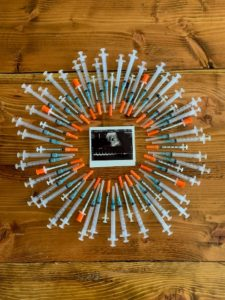 Ultrasound surrounded by treatment milestones